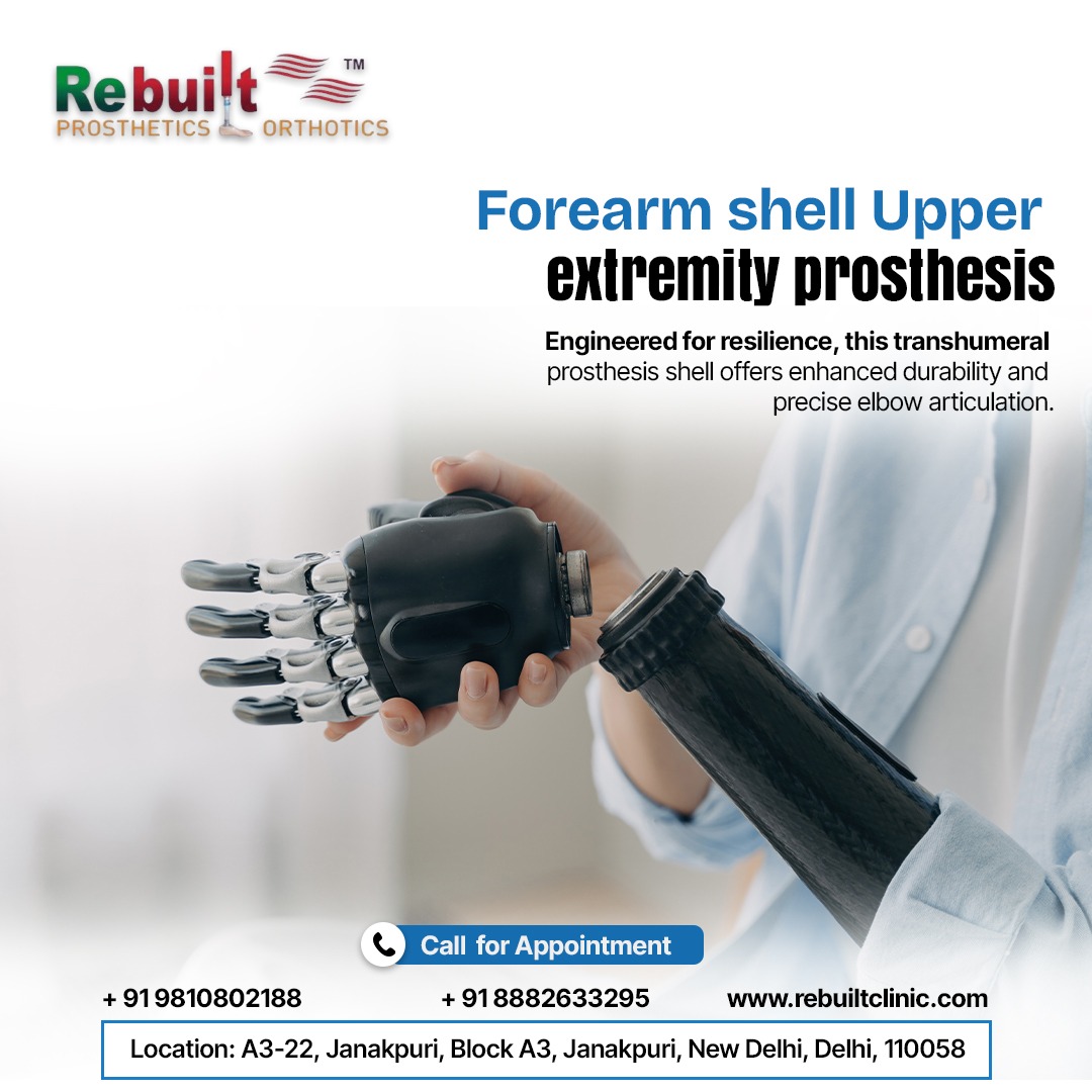 Life with Prosthetics – Adapting with Confidence